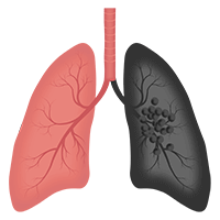 Pneumologie